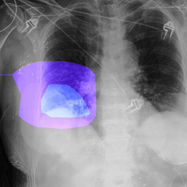 medical image analysis AI - Growth of AI in medical image analysis raises concerns about trust
