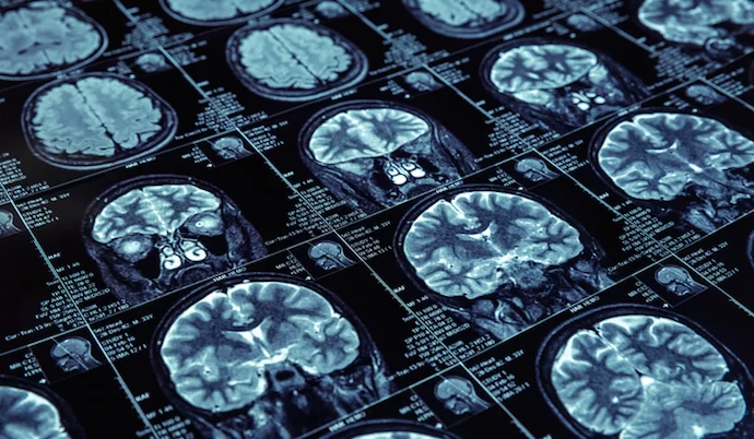 medical imaging AI - How Artificial Intelligence is Changing Medical Imaging - Radius ...